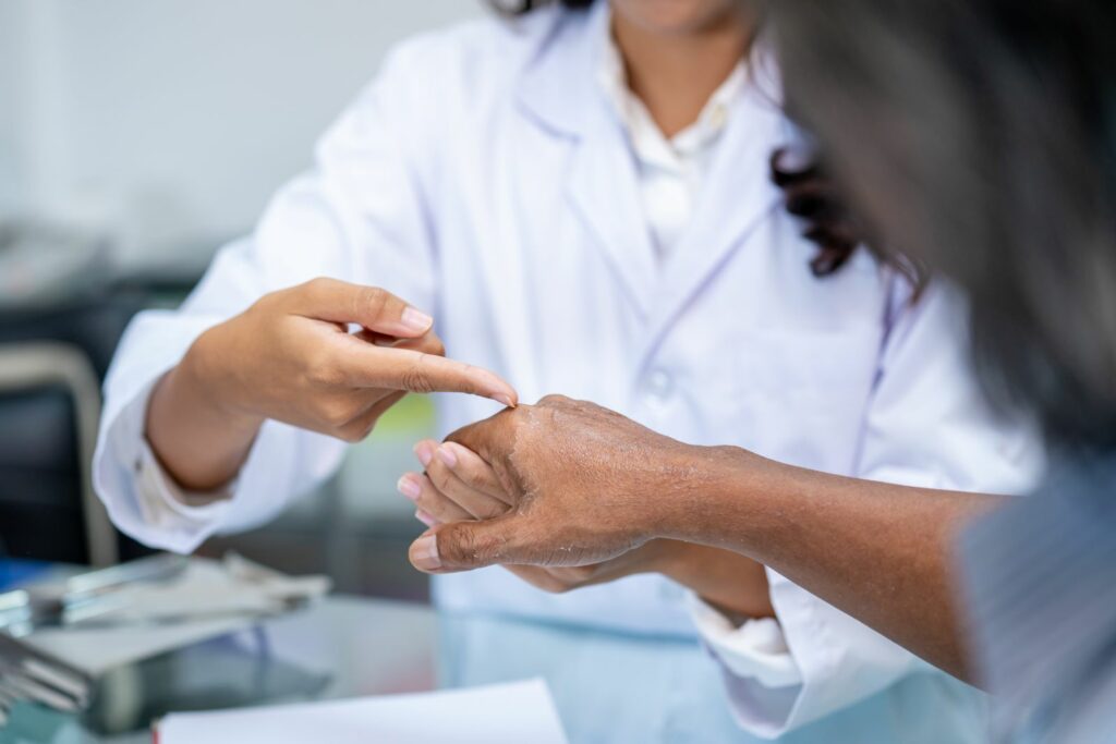 Dermatologist examining dry, irritated skin on a patient's hand